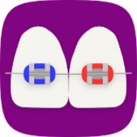 BraceMate (App ไอเดียเลือกสียางจัดฟัน ในการดัดฟัน)