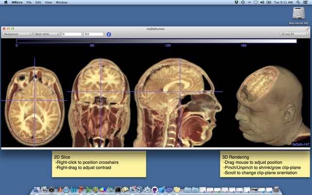 MRIcro (โปรแกรม MRIcro เปิดไฟล์รูปภาพทางการแพทย์ MRI บน Mac) : 