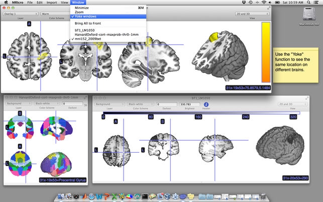 MRIcro (โปรแกรม MRIcro เปิดไฟล์รูปภาพทางการแพทย์ MRI บน Mac) : 