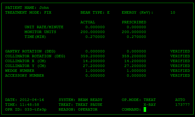 ตัวอย่าง User Interface ของเครื่องฉายรังสี Therac-25